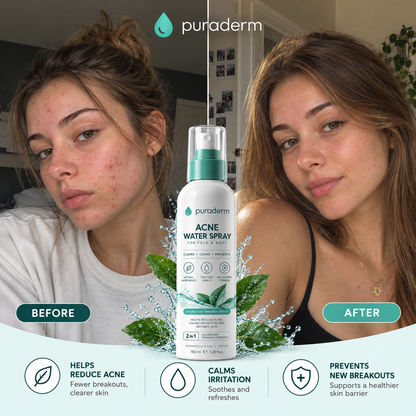 Puraderm™ Acne Spray